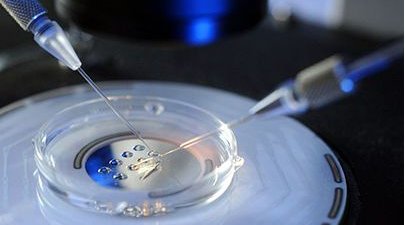 影响新加坡试管婴儿成功率的因素？新加坡试管婴儿成功前的准备？新加坡试管婴儿技术优势！